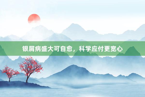 银屑病盛大可自愈，科学应付更宽心